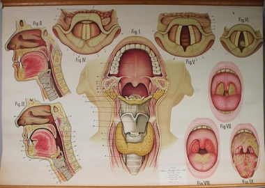 Poster - Throat, Pharynx and Larynx