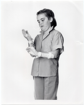 B&W photo of a girl wearing a hand and arm orthopaedic splint on each arm. She is looking down at her right hand and arm. She is wearing a short-sleeved shirt and trousers. Behind her is a plain background.