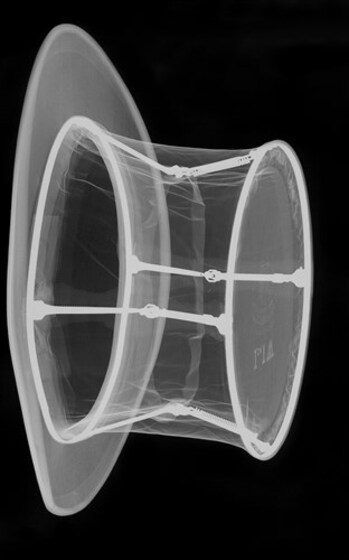 X-ray of a top hat