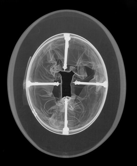 X-ray of a top hat