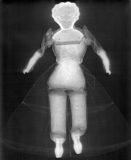 An x-ray of a doll, the head, arms and legs lit up in white and a faint outline of the dress skirt and sleeves