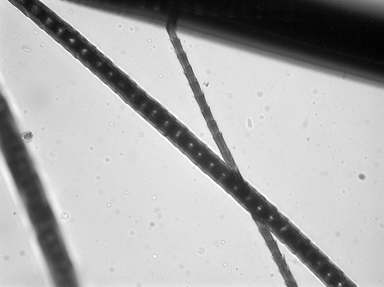 Detailed x-ray of fibres which appear as black lines on a white background.